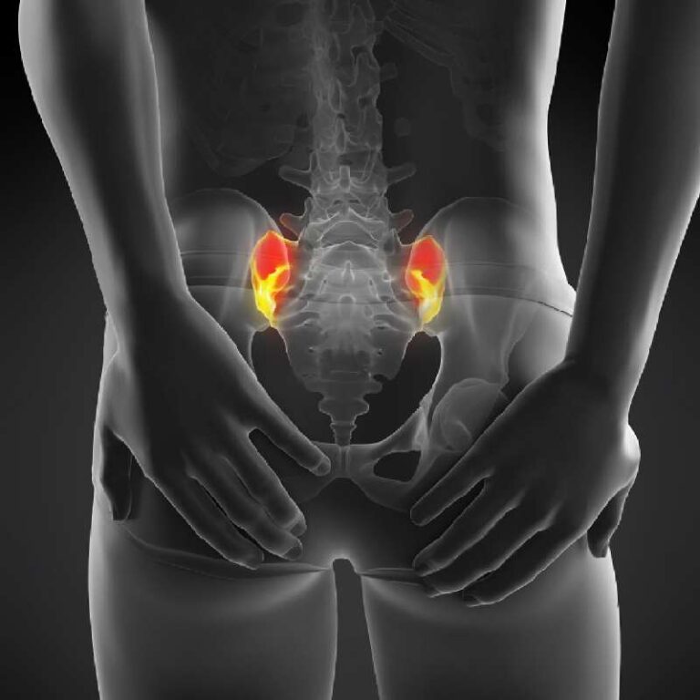 Ból stawu krzyżowo-biodrowego