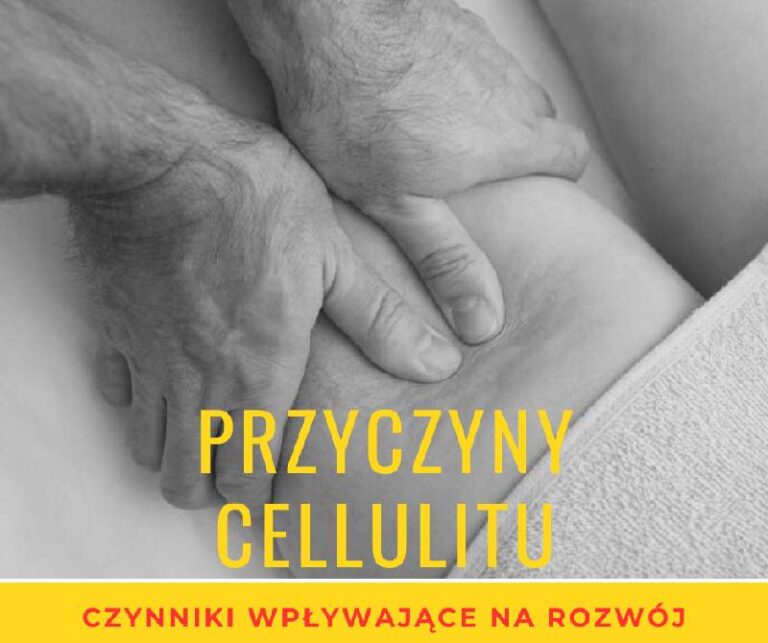 Przyczyny cellulitu: Badanie głównych czynników wpływających na rozwój cellulitu