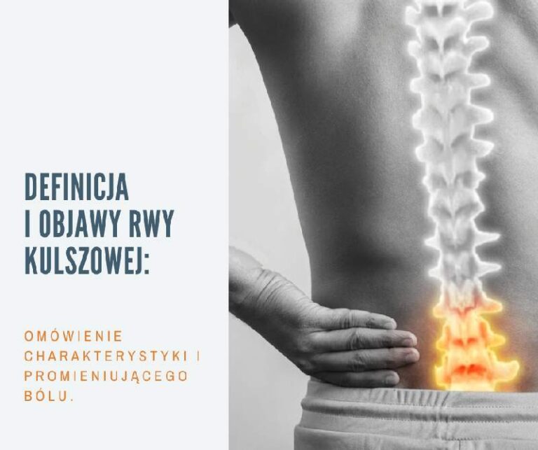 Definicja i objawy rwy kulszowej.