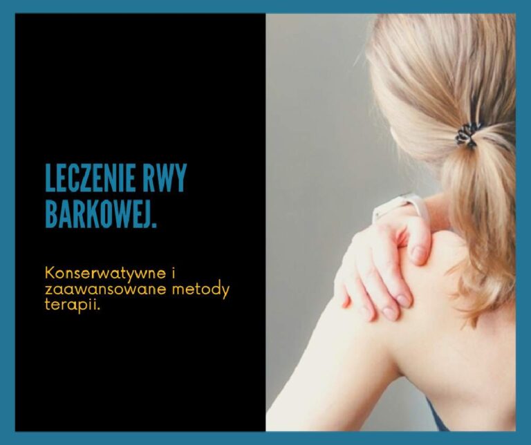 Leczenie rwy barkowej.